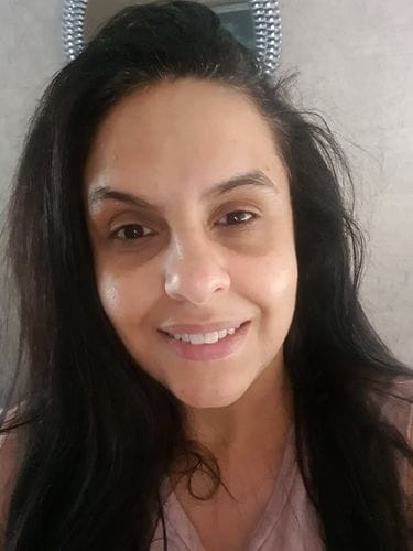 Customer photo review of Retinol Serum 30ml