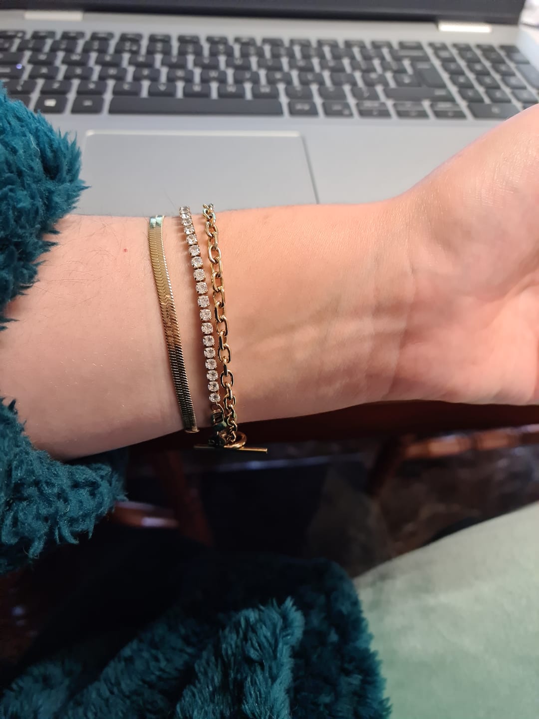 Customer photo review of Essentials Bracelet