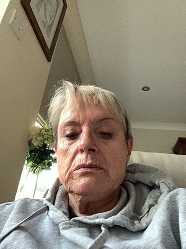 Customer photo review of Triple Vitamin C Serum 30ml