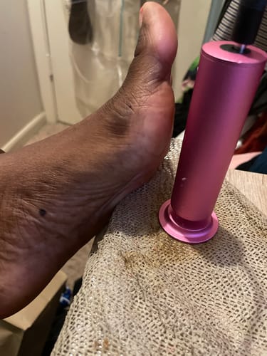 Customer photo review of Dermave™ Electric Foot Callus Remover