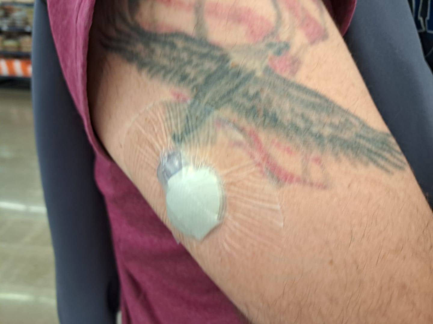 Customer photo review of Skin Grip Original - Medtronic Guardian/Enlite Adhesive Patches