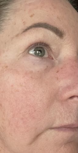 Customer photo review of Hyaluronic Acid Serum 30ml