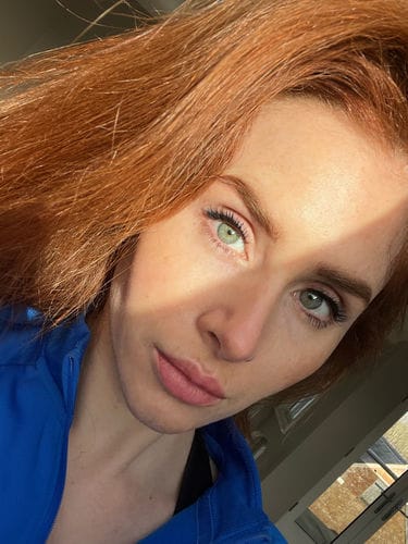 Customer photo review of Triple Vitamin C Serum 30ml