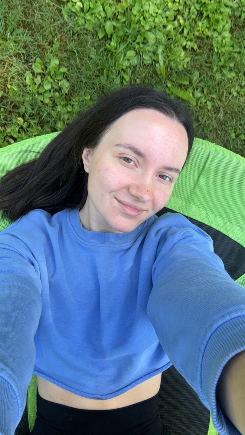 Customer photo review of Balinošs toniks-esence ādas mitrināšanai Numbuzin No.3 Super Glowing Essence Toner