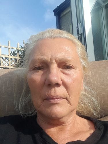 Customer photo review of Triple Vitamin C Serum 30ml