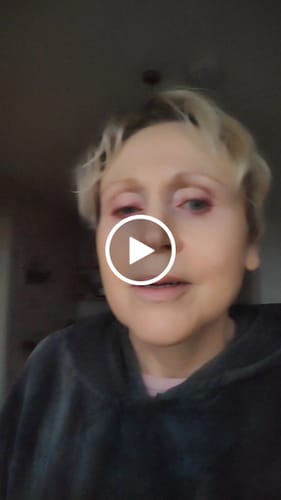 Customer video review of Anti-Aging treatment