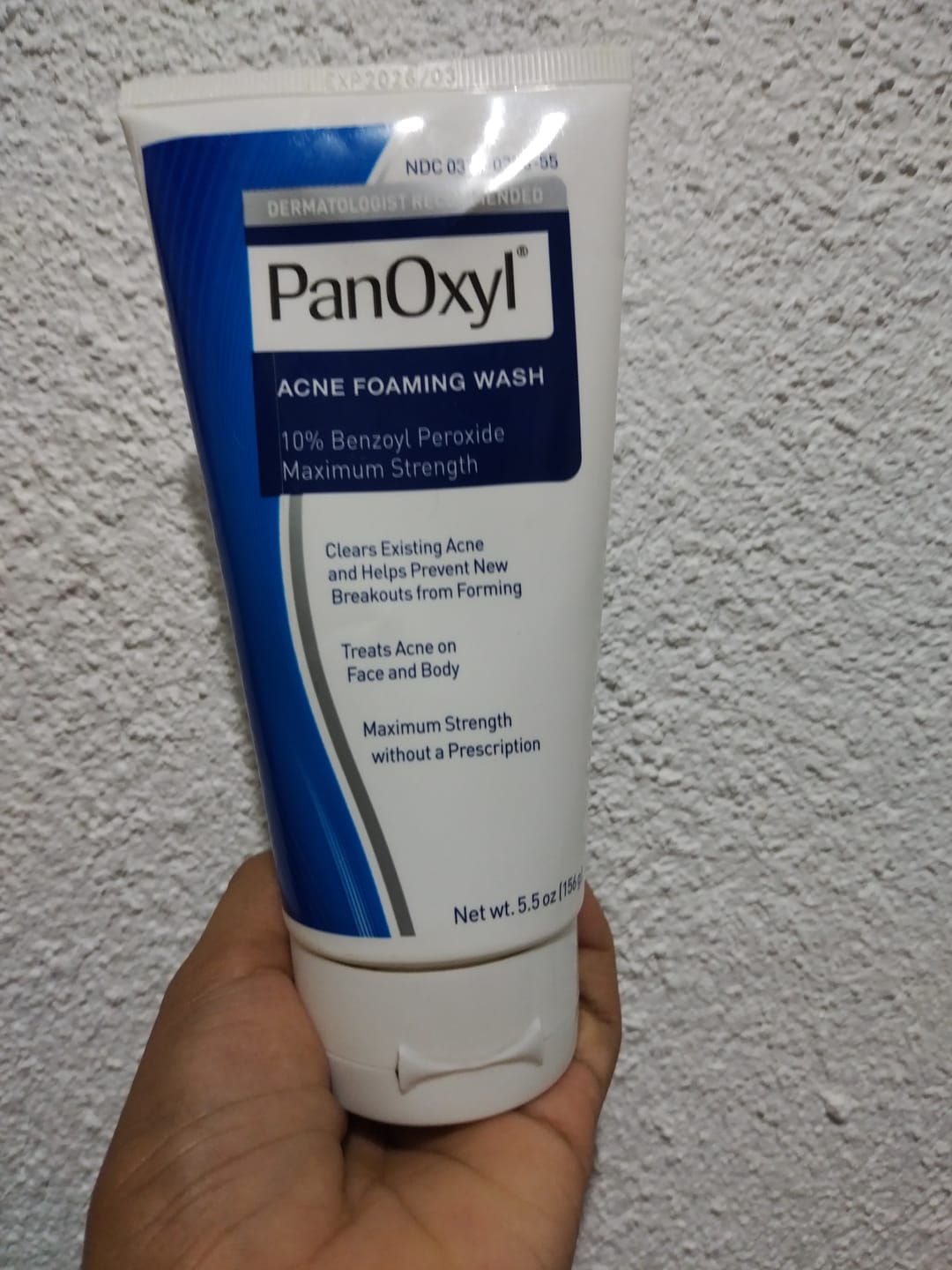 Customer photo review of PanOxyl Maximum Strength Antimicrobial Acne Foaming Wash for Face