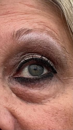 Customer photo review of Peptide Eye Cream 30ml