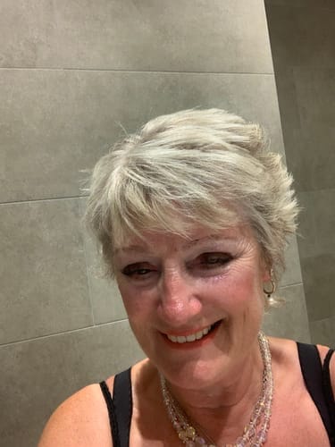 Customer photo review of Retinol Serum 30ml