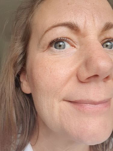 Customer photo review of Hyaluronic Acid Serum 30ml