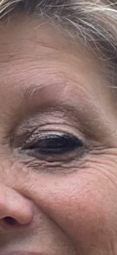 Customer photo review of Peptide Eye Cream 30ml