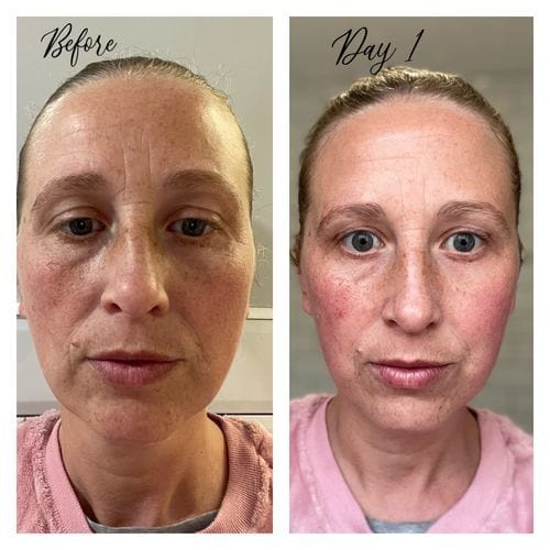 Customer photo review of Peptide Face & Neck Night Cream 50ml