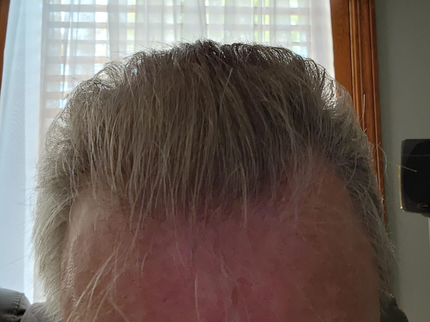Customer photo review of MODA - Moisturizing Shampoo for All Hair Types, Deep Cleanse, Strengthen & Restore, 128 Oz