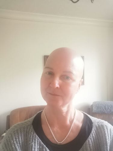 Customer photo review of Hyaluronic Acid Serum 30ml