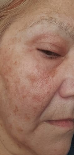 Customer photo review of The Age-Reversal Duo