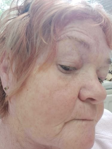 Customer photo review of Hyaluronic Acid Serum 30ml