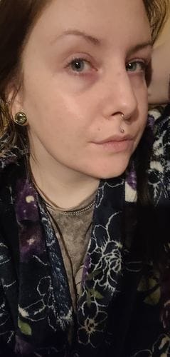 Customer photo review of Retinol Serum 30ml