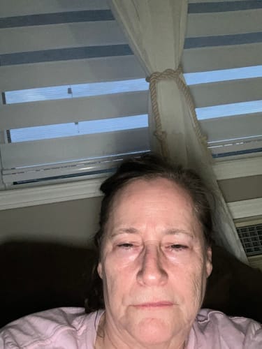 Customer photo review of Retinol Serum 30ml