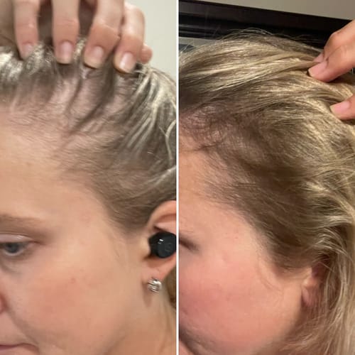 Customer photo review of Pre-Wash Scalp Oil by TR