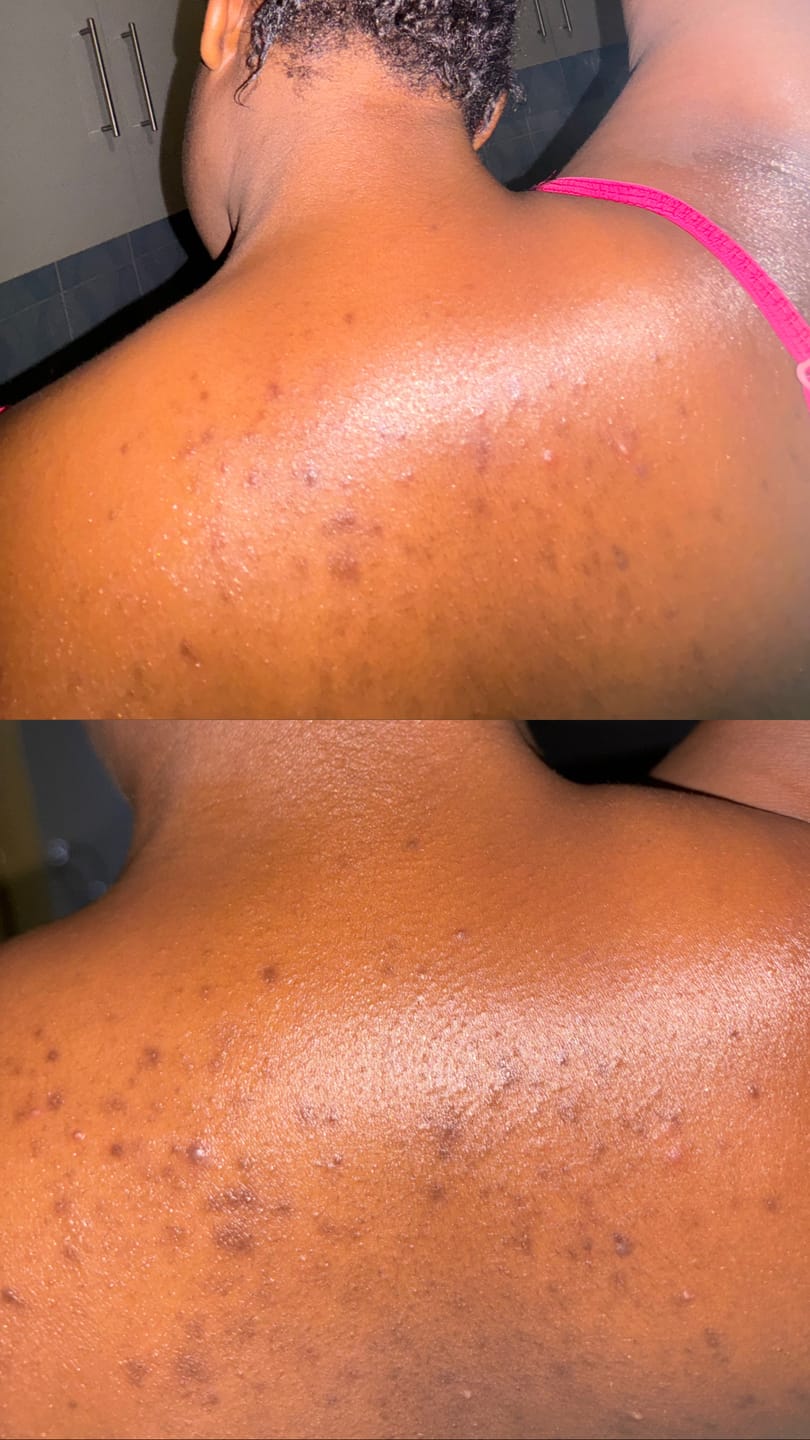 Customer photo review of Bright Skin Bish