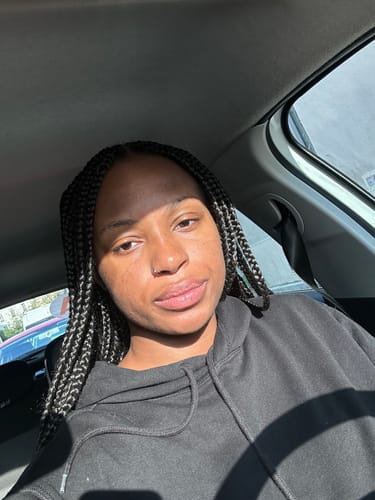 Customer photo review of Serum glow oil