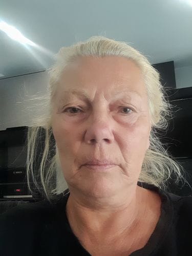 Customer photo review of Peptide Face & Neck Night Cream 50ml