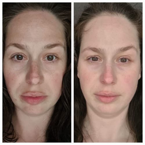 Customer photo review of Retinol Serum 30ml