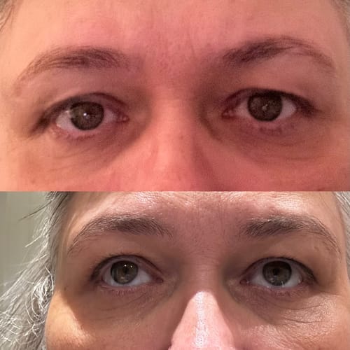 Customer photo review of Peptide Eye Cream 30ml