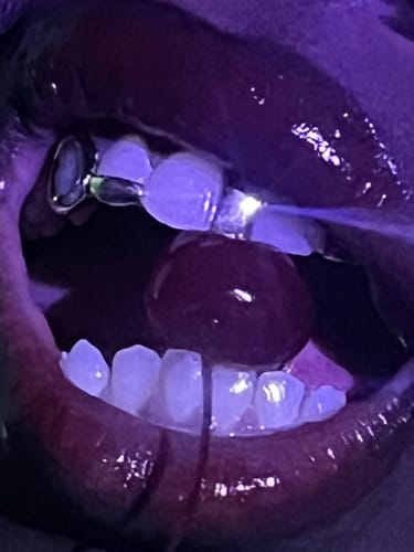 Customer photo review of ORBIT (GOLD GRILLZ)