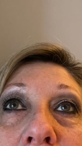 Customer photo review of Peptide Eye Cream 30ml