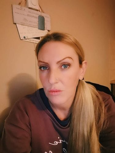 Customer photo review of Retinol Serum 30ml