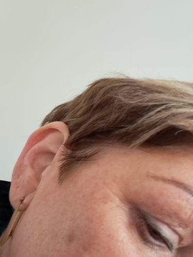 Customer photo review of Hyaluronic Acid Serum 30ml
