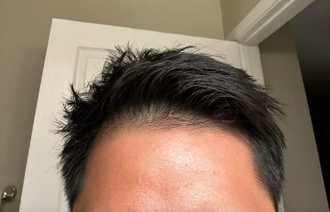 Customer photo review of Volumane Anti-Thinning Stimulating Shampoo