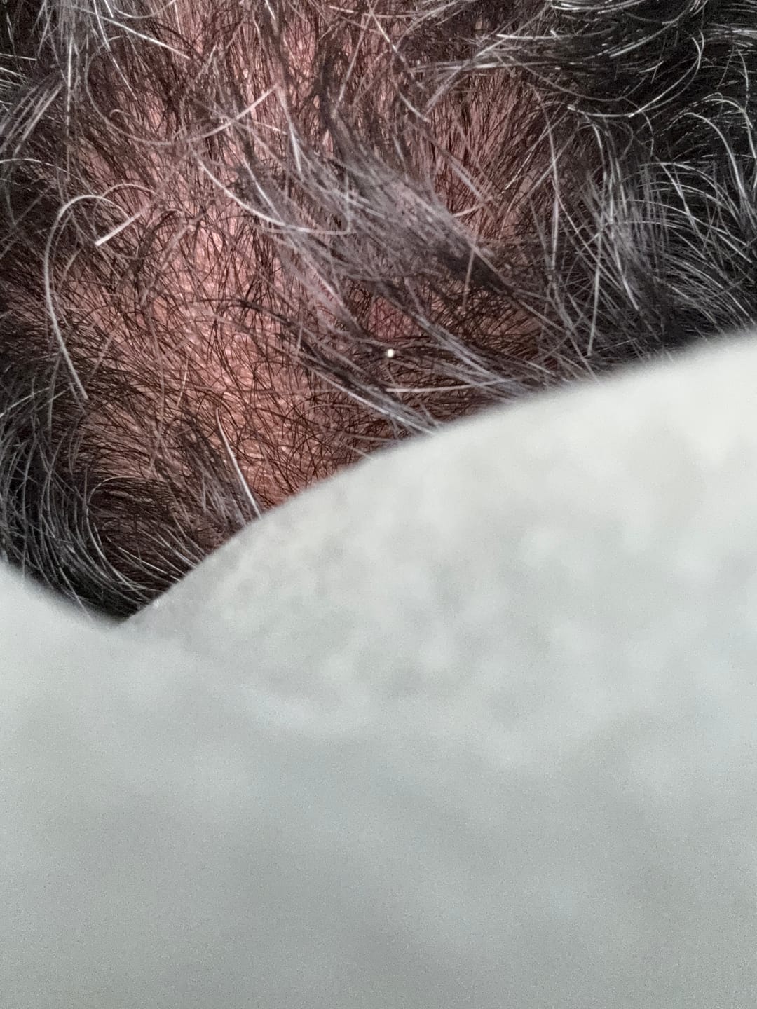 Customer photo review of Kit Adiós Alopecia