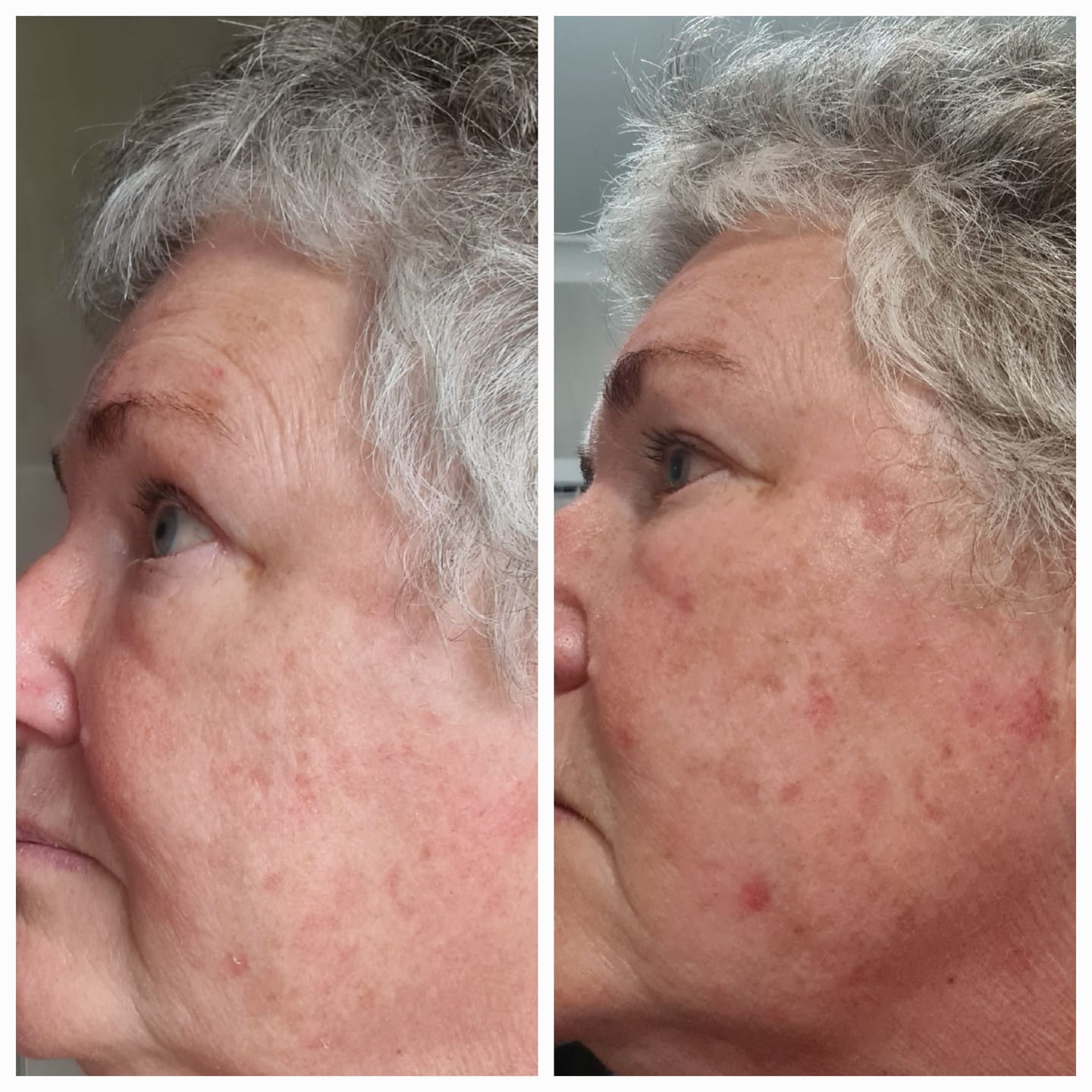 Customer photo review of MAGNESIUM SUPER STICK