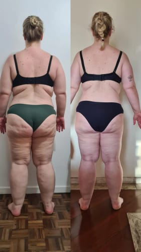 Customer photo review of Bumbum Cream (500g)