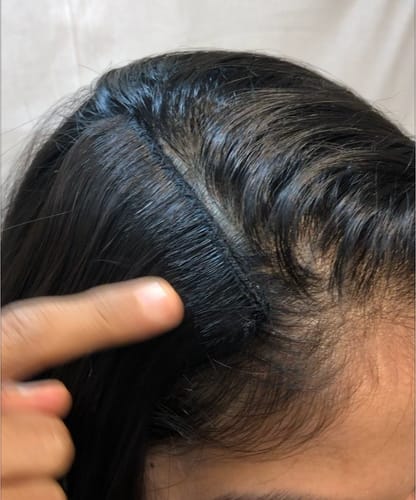 Customer photo review of Volume Boost Side Patch (Siders) Comes In Pair