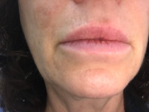 Customer photo review of EvenSkyn® Conduction Gel (300ml)