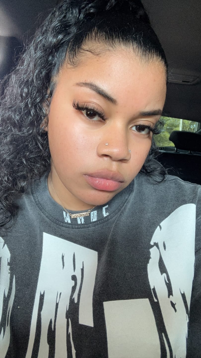 Customer photo review of Dark Spot Eraser Lotion