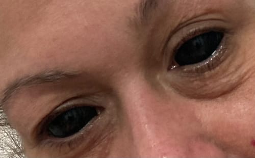 Customer photo review of Halloween 22mm Black Sclera Colored Contact Lenses