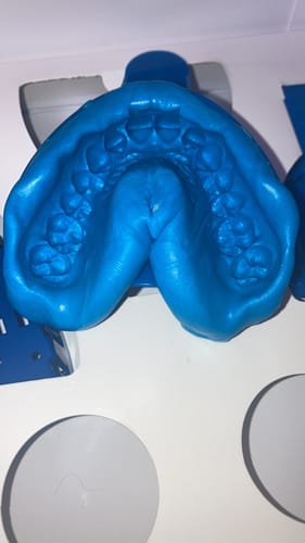 Customer photo review of Essix Retainers