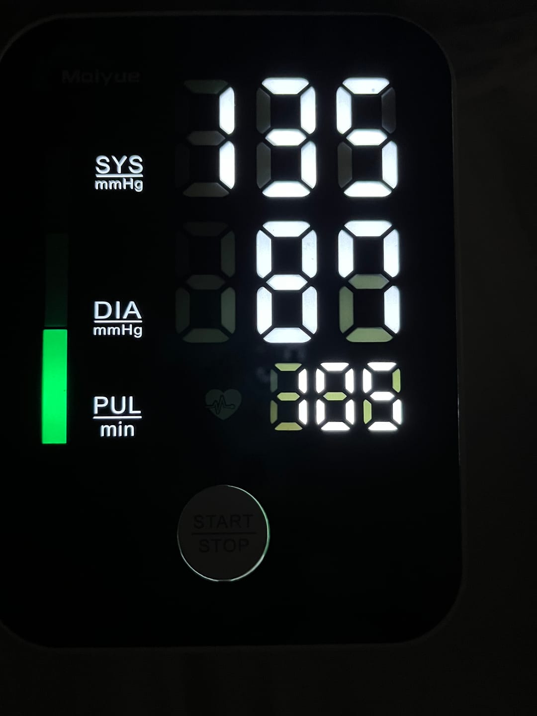 Customer photo review of Zeer nauwkeurige bovenarm bloeddrukmeter / meten via bovenarm / detectie van hartritmestoornissen / met slimme geheugenfunctie voor thuisgebruik (bloeddrukmeter)