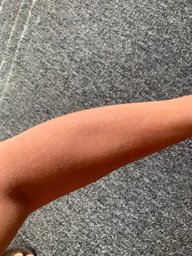 Customer photo review of FREE Signature Tallow Skin Balm (2oz)