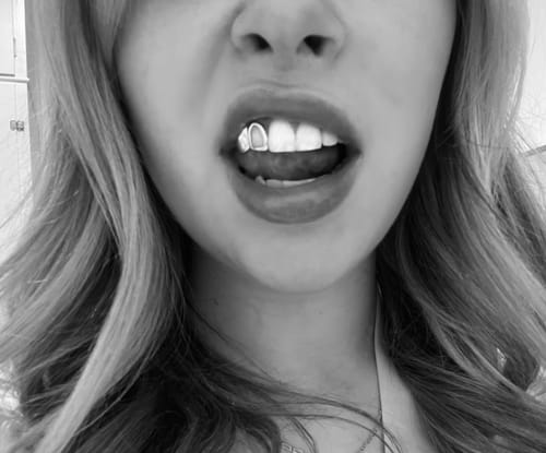 Customer photo review of PRISM (GOLD GRILLZ)