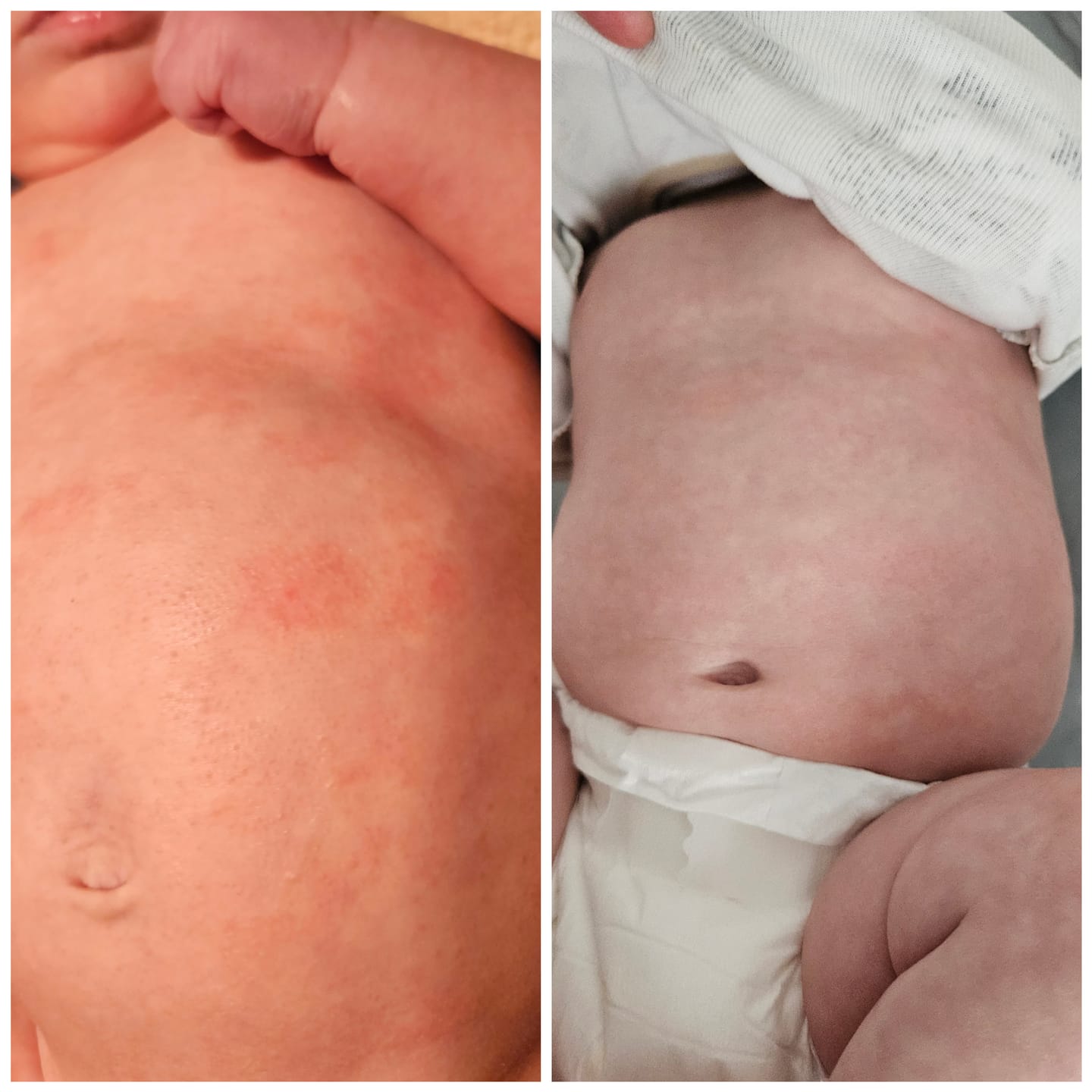Customer photo review of Skin Rescue Set Lavender & Calendula