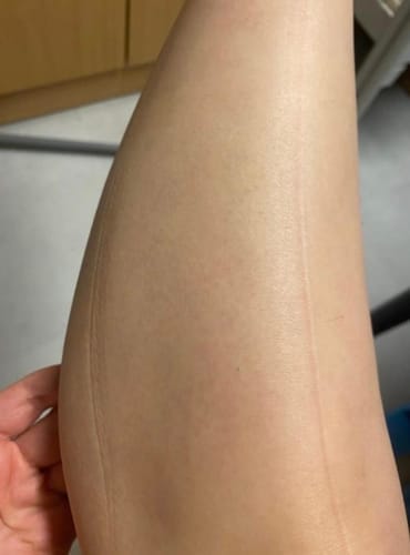 Customer photo review of Lunera IPL Pro
