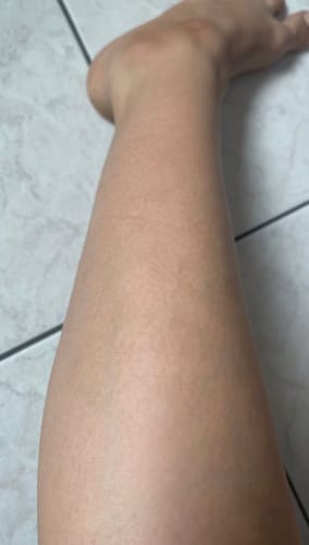 Customer photo review of Lunera IPL Pro