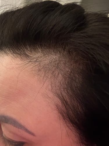 Customer photo review of Hair & Nail Capsules