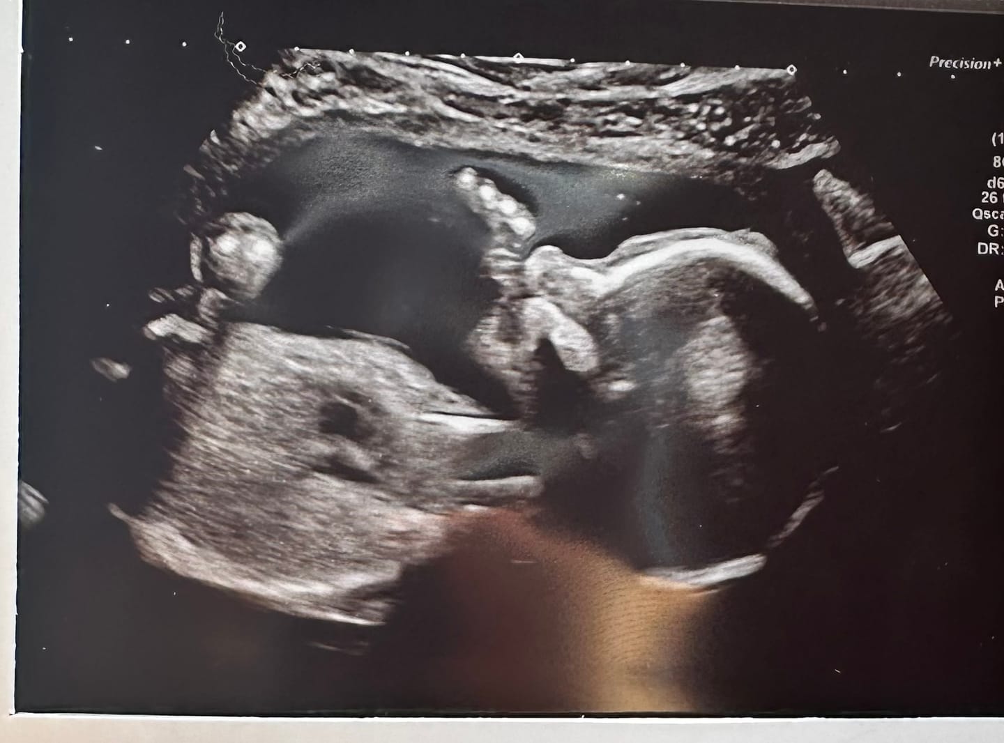 Customer photo review of Fertility Supplement