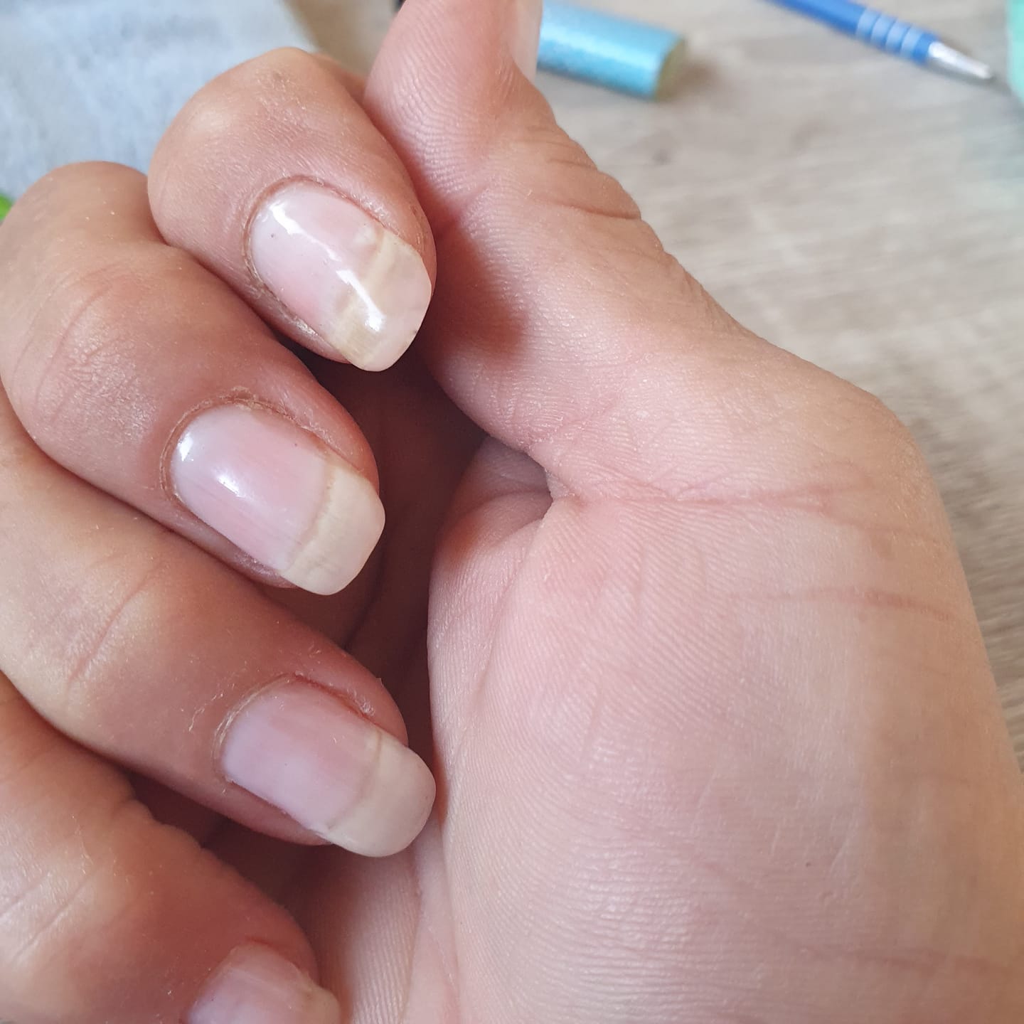 Customer photo review of "Studios Didier" "Strong Fiber Base" erős üvegszálas alapozó, 8ml